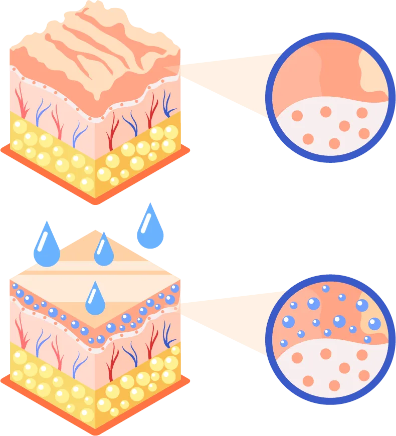 Two isometric blocks of skin. The upper one is cracked and dry, with a magnified circle showing a rough surface. The lower one has water droplets soaking in and blue dots spread through its layers.